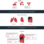 mesothelioma and asbestos infographic